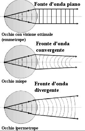 aberro1