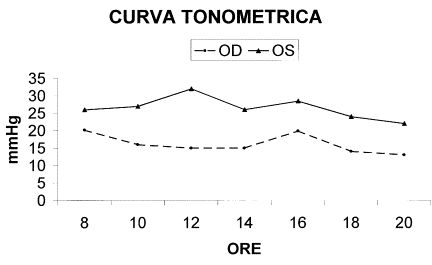 tonometrica
